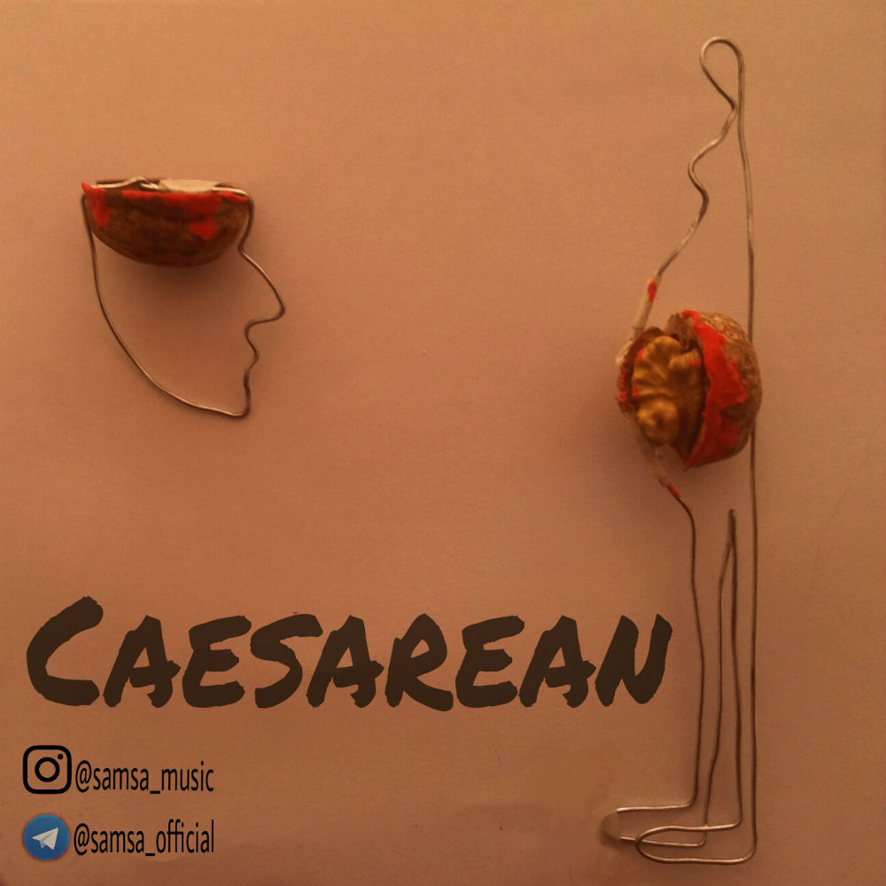 Samsa - Caesarean