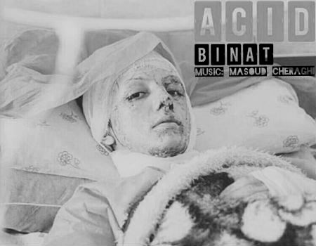 بینات - اسید