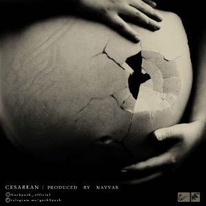 آهنگ سزارین از گروه گچ پژ